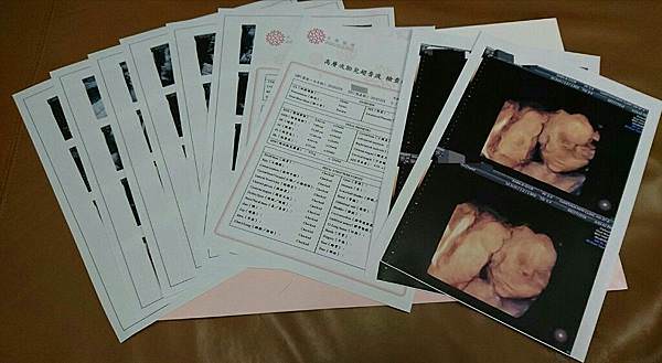 |小飛日記|23W0D 高層次超音波 - 第1張圖