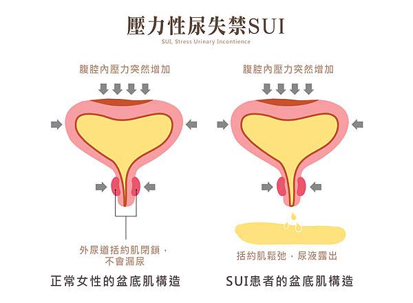 G緊雷射_7(1).jpg